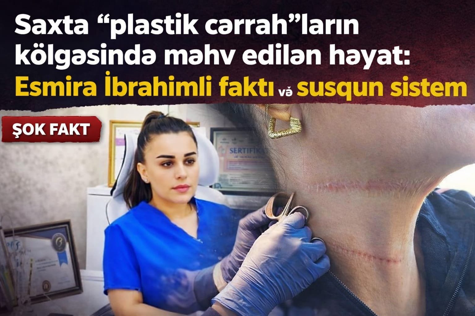 “İzsiz əməliyyat” vədi ilə başlayan kabus: 1 il sonra görünən həqiqət – Saxta "həkim" Esmira İbrahimli faktı